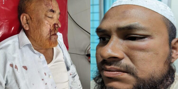 চকরিয়ায় ফিল্মীস্টাইলে সিমেন্ট ডিলারের দোকানে হামলা,টাকা লুট,আহত ৩ 1 চকরিয়ায় ফিল্মীস্টাইলে সিমেন্ট ডিলারের দোকানে হামলা,টাকা লুট,আহত ৩