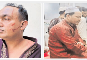 চকরিয়ায় সোসাইটি মসজিদের কমিটি নিয়ে দুই পক্ষে মারামারি, পাল্টা হামলায় আহত ৮