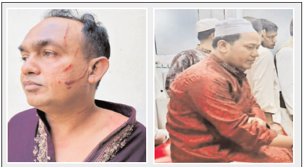 চকরিয়ায় সোসাইটি মসজিদের কমিটি নিয়ে দুই পক্ষে মারামারি, পাল্টা হামলায় আহত ৮ 1 চকরিয়ায় সোসাইটি মসজিদের কমিটি নিয়ে দুই পক্ষে মারামারি, পাল্টা হামলায় আহত ৮