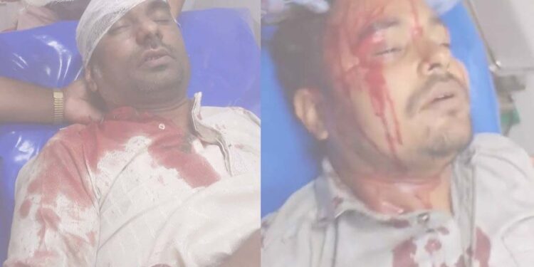 মোটর সাইকেল থামিয়ে পৌর যুবলীগের সভাপতি হাসানগীর ও যুবলীগ নেতা কামরানকে কুপিয়ে জখম, শহরে উত্তেজনা