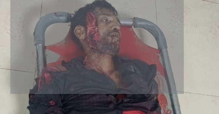 চকরিয়ায় এক ব্যক্তিকে কুপিয়ে হত্যা