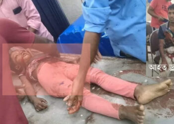 মহেশখালীতে টমটম গাড়ির ধাক্কায় ৬বছরে এক শিশুর মৃত্যু সহ বেশ কয়েকজন আহত