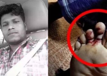 পেকুয়ায় সাপের কামড়ে প্রবাসীর মৃত্যু