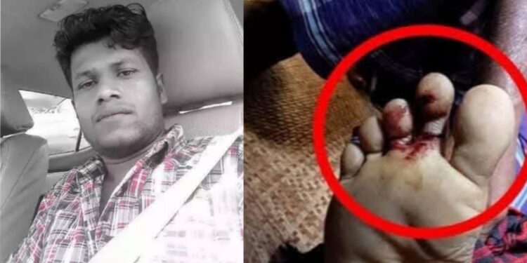 পেকুয়ায় সাপের কামড়ে প্রবাসীর মৃত্যু